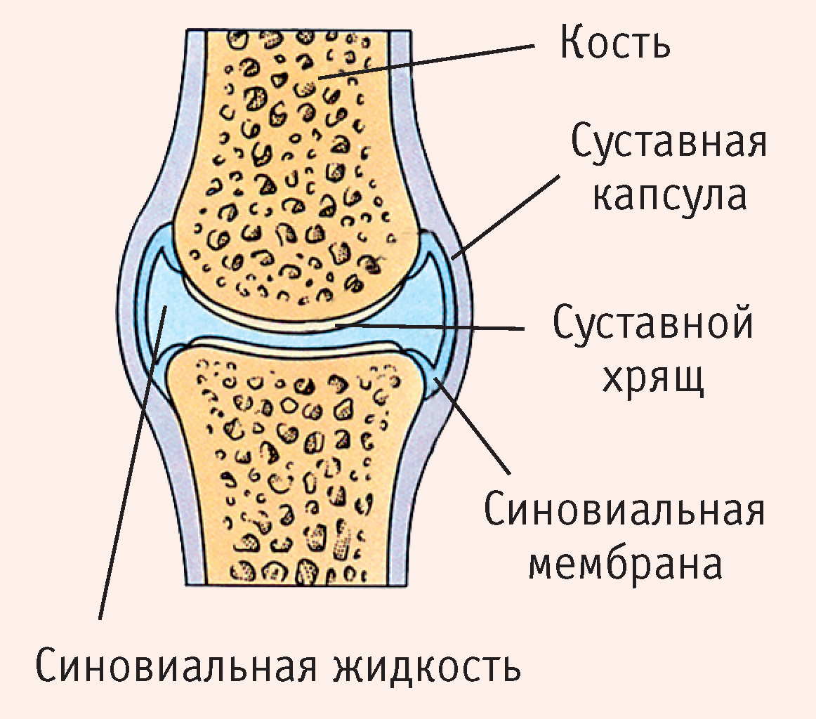 Рис. 2. Строение сустава: суставная капсула, кость, суставной хрящ, синовиальная жидкость, синовиальная мембрана 